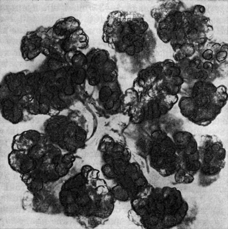 Рис. 277. Представитель протококковых водорослей Botryococcus braunii, нередко вызывающий 'цветение' воды