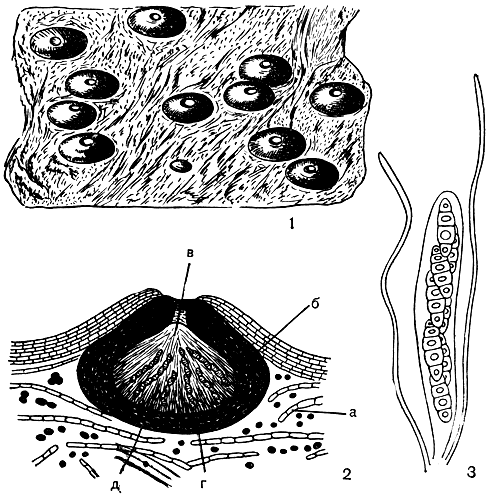 Рис. 314. Pyrenula nitida: 1 - общий вид слоевища с перитециями; 2 - поперечный разрез перитеция и слоевища (а - слоевище, б - стенки перитеция; в - устьице, г - сумки со спорами, д - парафизы); 3 - сумки со спорами и парафизы