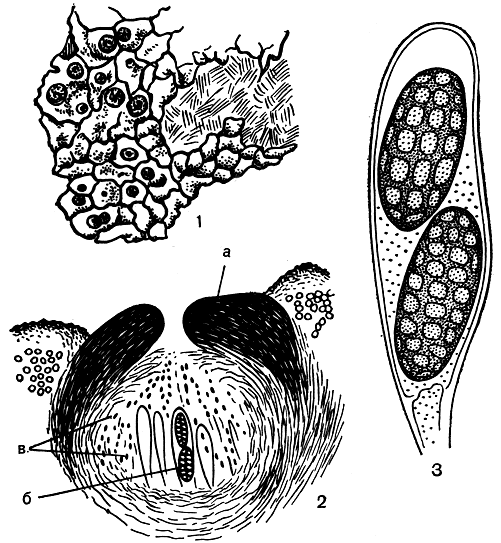 Рис. 316. Staurothele clopima: 1 - общий вид слоевища с перитециями; 2 - поперечный разрез через перитеций (а - эксципул, б - сумки, в - гимениальные водоросли); 3 - сумка со спорами