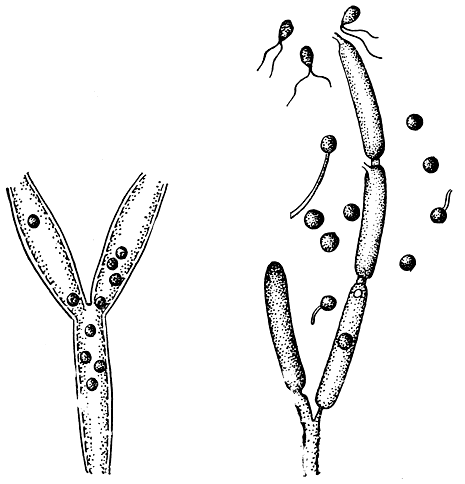 Рис. 18. Лептомитус (Leptomitus). Общий вид таллома с зооспорангиями