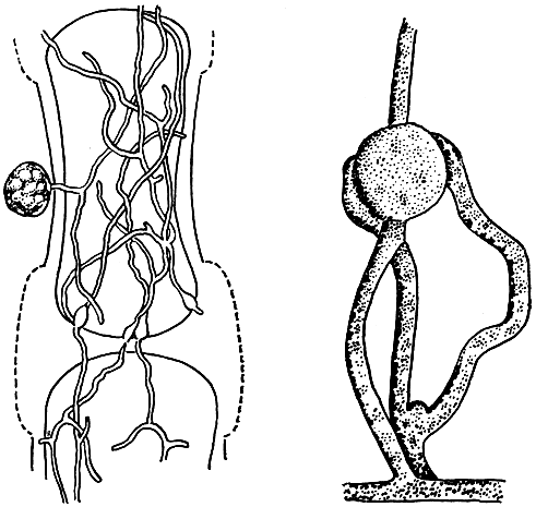 Рис. 24 (слева). Поражение красной водоросли церамиум питиумом (Pythium maritimum): 1 - мицелий внутри клеток водоросли; 2 - освобождение зооспор