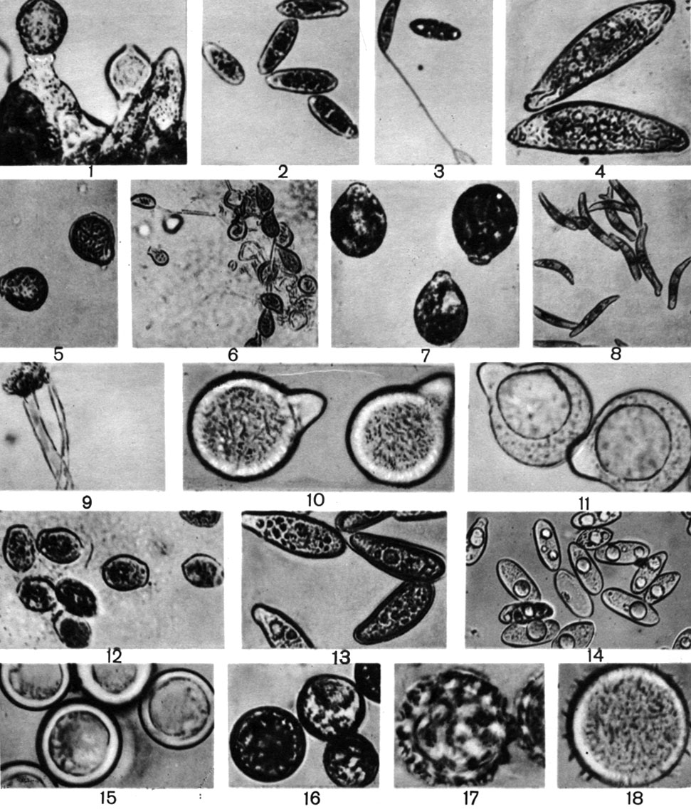 Таблица 12. Конидии и покоящиеся споры энтомофторовых грибов: 1 - энтомофтора мушиная (Entomophthora muscae): конидиеносцы с конидиями; 2 - энтомофтора сферосперма (Е. sphaerosperma): конидии; 3 - тот же гриб - конидии с капиллярными конидиеносцами и вторичная конидия; 4 - энтомофтора ризоспора (Е. rhyzospora): конидии; 5 - энтомофтора Фрезениуса (Е. fresenii): конидии; 6 - тот же гриб: первичные и миндалевидные вторичные конидии; 7, 8 - конидии энтомофторы Грилли (Е. grilli) и энтомофторы конической (Е. conica); 9 - ризоиды энтомофторы апикулята (Е. apiculata); 10-14 - конидии энтомофторы корончатой (Е. coronata), энтомофторы Такстера (Е. thaxteri), энтомофторы комариной (Е. culicis), энтомофторы дугоспоровой (Е. curvispora), энтомофторы тли (Е. aphidis); 15-18 - покоящиеся споры энтомофторы сферосперма (Е. sphaerosperma), энтомофторы Такстера (Е. thaxteri), энтомофторы Фрезениуса (Е. fresenii), энтомофторы шиповатоспоровой (Е. echinospora), энтомофторы корончатой (Е. coronata)