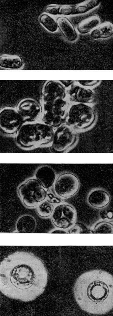 Рис. 60. Микрофотографии дрожжей (сверху вниз): Schizosaccharomyces pombe (вегетативные клетки и сумка с четырьмя спорами); Schizosaccharomyces octosporus (делящиеся клетки и сумка с восемью спорами); Saccharomyces cerevisiae (вегетативные клетки и сумка со спорами); Lipomyces starkeyi (капсулы)
