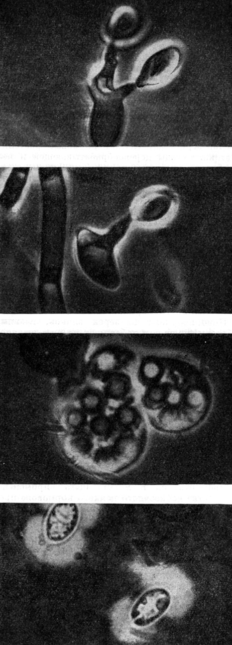 Рис. 61. Микрофотографии дрожжей (сверху вниз): Sporobolomyees roseus (клетки со стеригмами и баллистоспорами); то же; Lipomyces starkeyi (сумка со спорами); Cryptococcus diffluens (капсулы)