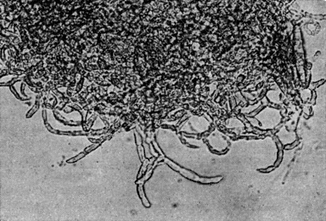 Рис. 77. Наницция загнутая (Nanizzia incurvata) Часть клейстотеция