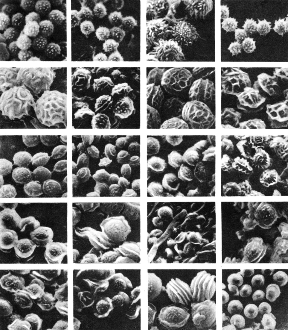 Таблица 15. Аскоспоры эупенициллов (Eupenicilliom) (фото в сканиоуемом микроскопе)