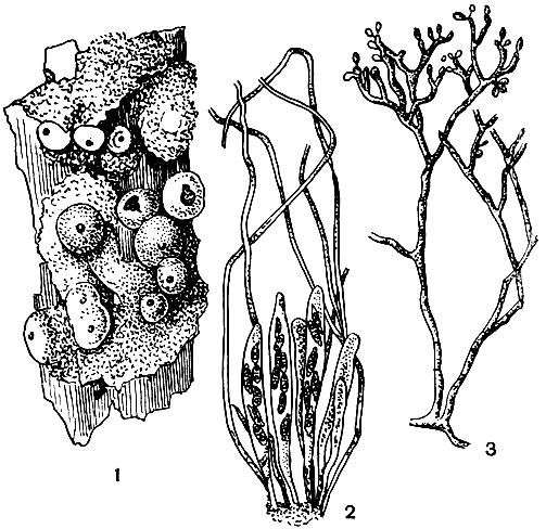 Рис. 94. Розеллиния (Rosellinia): 1 - перитепий; 2 - сумки и парафизы; 3 - конидиальное спороношение