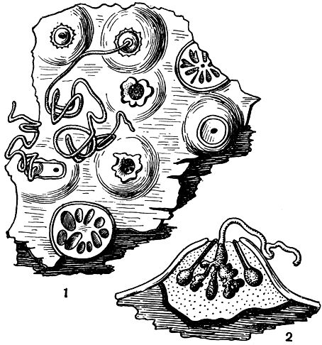 Рис. 103. Вальсоидная строма гриба ральса белоснежная (Valsa nivea) с конидиальными спороношениями: 1 - вид сверху; 2 - вид сбоку (в разрезе)
