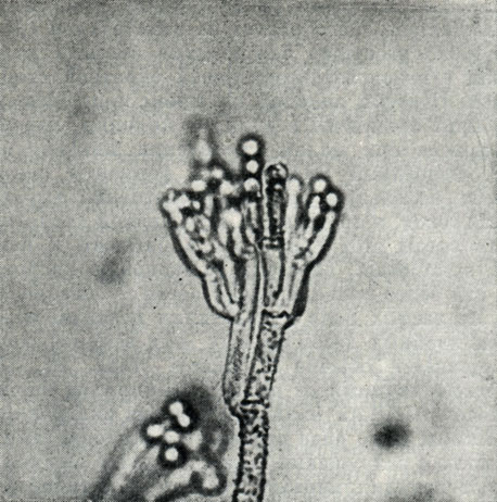 Рис. 232. Конидиеносец пеницилла Penicillium cyclopium