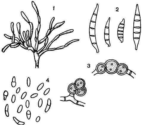 Рис. 242. Спороношение фузариума (Fusarium): 1 - формирование конидий; 2 - макроконидии; 3 - хламидоспоры; 4 - микроконидии
