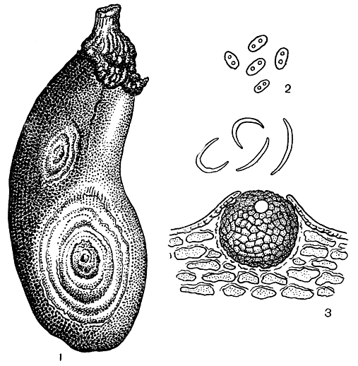 Рис. 255. Фомопсиоз, или сухая гниль, баклажан (возбудитель - Phomopsis vexans): 1 - пораженный плод; 2 - конидии; 3 - пикнида