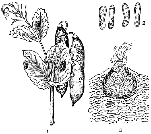 Рис. 258. Аскохитоз гороха (возбудитель - Ascochyta pisi): 1 - пораженные лист и боб гороха; 2 - конидии; 3 - разрез пикниды