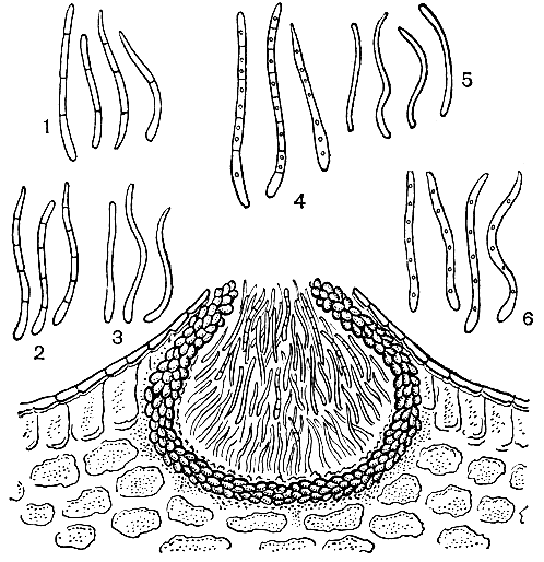 Рис. 262. Возбудители септориоза зонтичных: внизу - разрез пикниды септории сельдерея (Septoria apii); вверху - конидии различных видов возбудителей: 1 - септория сельдерея (S. apii); 2 - септория тмина (S. cari); 3 - септория зонтичных (S. umbelliferarum); 4 и 5 - септории пастернака (S. pastinacina, S. pastinaceae); 6 - септория петрушки (S. petroselini)