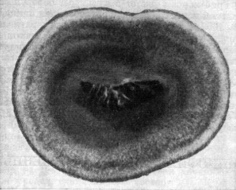 Рис. 266. Коремии гирзутеллы гигантской (Hirsutella gigantea) рост колонии этого гриба вокруг пораженной куколки насекомого