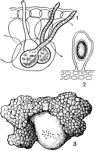 Рис. 28. Первичные грибы (Archimycetes): 1 - ольпидиум (Olpidium); виден зооспорангий в клетках коры корневой шейки капусты; 2 - циста синхитриума (Synchytrium); 3 - рак клубня картофеля (Synchytrium endobioticum)