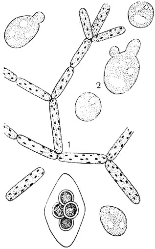 Рис. 32. Дрожжи (Saccharomyces): 1 - ветвистая колония винных дрожжей (Saccharomyces ellipsoideus); 2 - одиночные и почкующиеся клетки хлебных дрожжей (Saccharomyces cerevisiae); в одной из клеток видны четыре аскоспоры