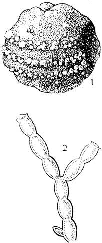 Рис. 39. Склеротиния (Sclerotinia) 1 - яблоко с конидиальными спороношениями гриба, расположенными концентрическими кругами, часть плода мумифицируется; 2 - цепочка чонидиеспор