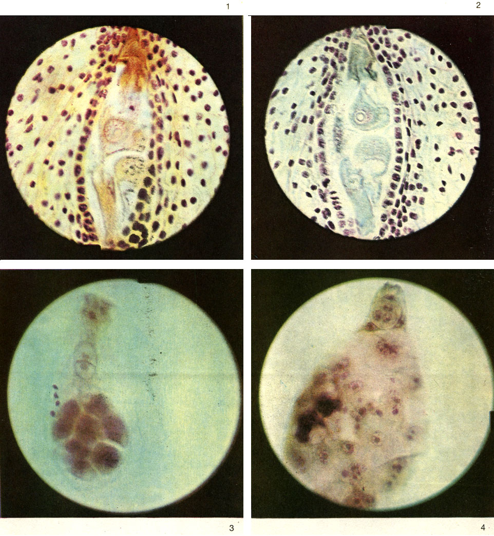Таблица 2. Оплодотворение у цветковых растений: 1 - продольный срез семязачатка с зародышевым мешком во время оплодотворения у рудбекии рассеченной (Rudbeckia laciniata); синергиды (желтого цвета) разрушаются; недалеко от ядра яйцеклетки красный спермий, в халазальной части 2 антиподы (3-я на другом, срезе), одна из них яйцеклеткоподобная; 2 - продольный срез семязачатка с зародышевым мешком во время оплодотворения у рудбекии рассеченной; в правую синергиду проникла пыльцевая трубка, ее ядро разрушено, зигота еще не приступила к делению, центральное ядро готовится к делению; в халазальной части 2 антиподы, одна из них яйцеклеткоподобная (3-я антипода на другом срезе); 3 - выделенный из семязачатка зародышевый мешок дюпонции Фишера (Dupontia fischeri); хорошо видна зигота, 2 контактирующих ядра и комплекс крупных антипод; слева - мелкие соматические клетки; 4 - выделенный зародышевый мешок с четырехклеточным зародышем, с ядрами эндосперма и дегенерирующими антиподами у фиппсии холодолюбивой (Phippsia algida)