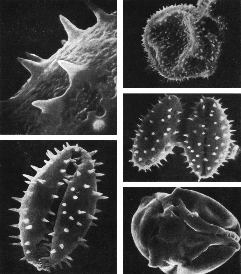 Таблица 22. Пыльцевые зерна нимфейных под сканирующим электронным микроскопом: слева вверху и внизу - кубышка желтая (Nuphar luteum, увел. 5000 и 1 500); справа вверху - эвриала устрашающая (Euryale ferox, увел. 5000); справа в середине - два зерна кубышки желтой, слева - с проксимальной, справа - с дистальной стороны (увел. 1000); справа внизу - виктория амазонская (Victoria amazonica), пыльцевые зерна в тетраде (увел. 1000)