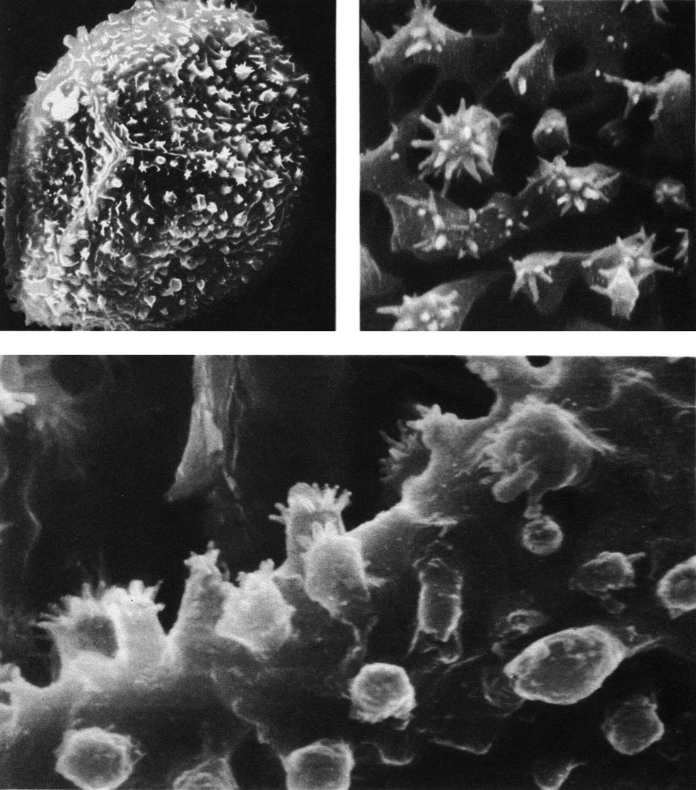 Таблица 27. Спора осмунды коричной (Osmunda cinnamomea) под сканирующем электронным микроскопом: вверху слева - увел. 4000, вверху справа - увел. около 25 000; внизу - увел. около 25 000