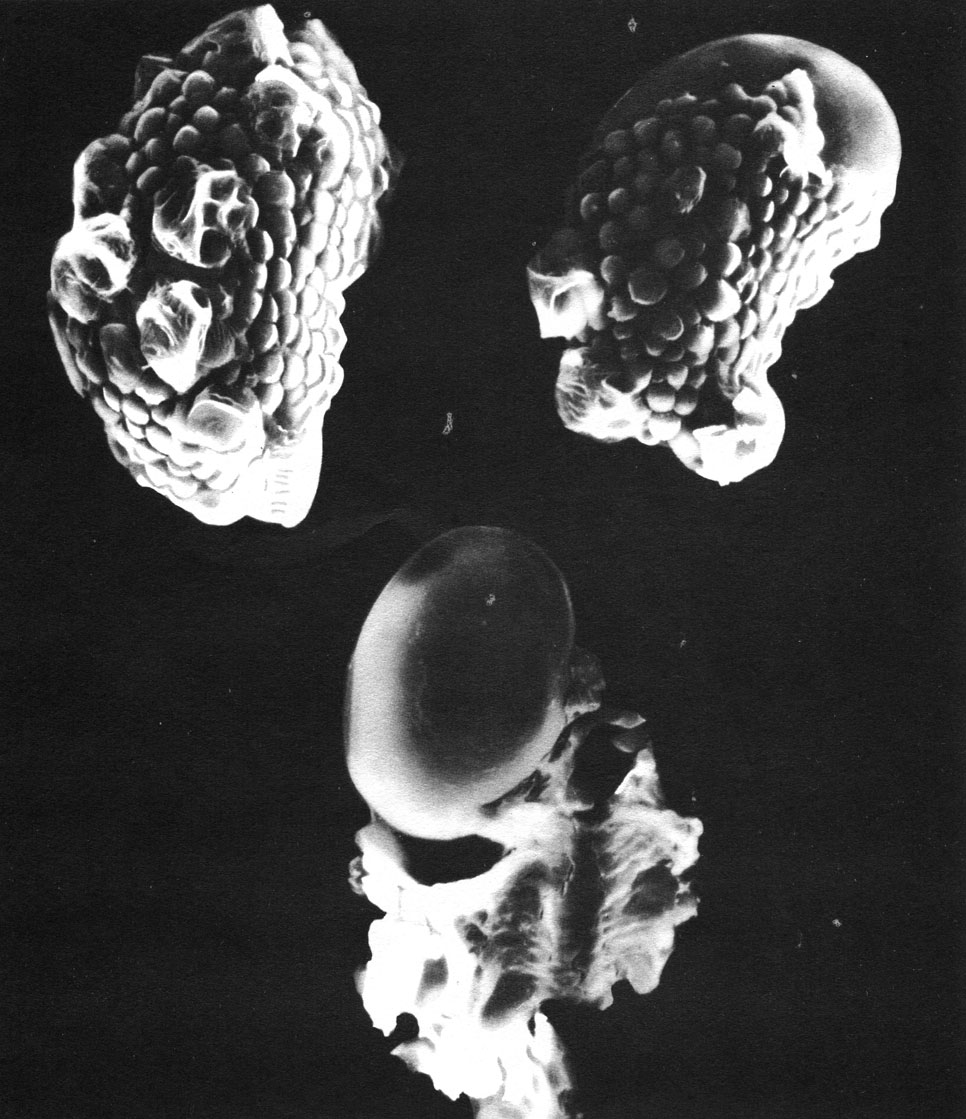 Таблица 28. Споры пиррозии прирастающей (Pyrrosia adnascens) под сканирующим электронным микроскопом (увел, около 1300): вверху слева - спора, поверхность которой образована периной (периспорием); вверху справа - перина частично сползла и на поверхности оказалась эктэкзина (экзоспорий); внизу - спора со сброшенной периной