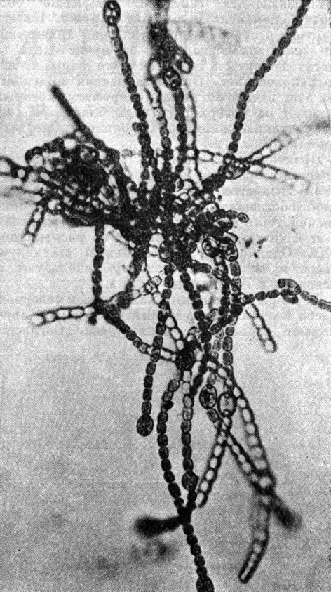 Рис. 158. Нити сине-зеленой водоросли анабены азоллы (Anabaena azollae), извлеченной из листьев азоллы каролинской (Azolla caroliniana)