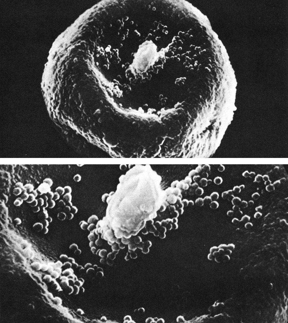 Таблица 64. Пыльцевое зерно тисса ягодного (Taxus baccata) под сканирующим электронным микроскопом (вверху - увел, около 5000, внизу - увел, около 13000)