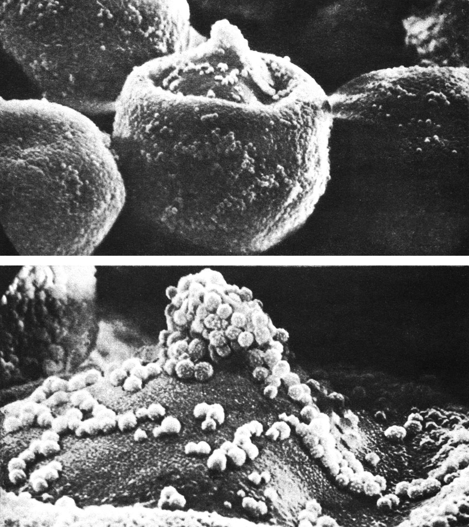 Таблица 57. Пыльцевые зерна криптомерии японской (Cryptomeria japonica) под сканирующим электронным микроскопом (увел. - вверху около 4000 и внизу около 12 000)