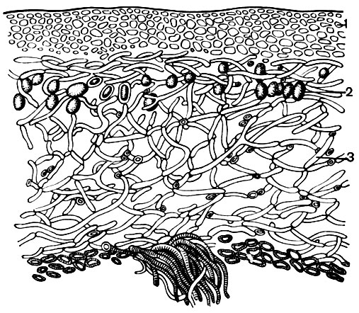Рис. 8. Поперечный разрез лишайника: 1 - корковый слой; 2 - включения клеток водорослей; 3 - гифы гриба. Внизу видны ризоиды