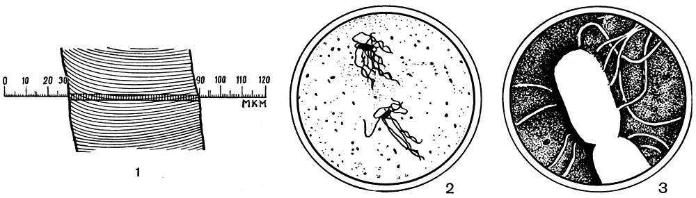 Рис. 1. Сравнительная величина волоса и бактерий: 1 - увеличенное изображение волоса (X 5 00); 2 - бактерии в поле зрения светового микроскопа (X 20 00); 3 - бактерии под электронным микроскопом (X 20 000)
