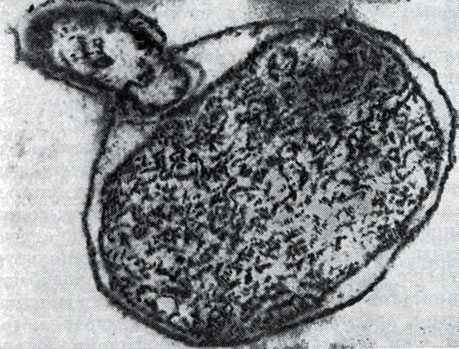 Рис. 23. Прохождение паразита внутрь клетки-хозяина. Ультратонкий срез (по Штольпу, 1963)