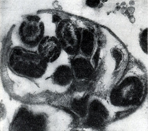 Рис. 25. Клетка бактерии-хозяина (Tuberoidobacter sp.), заполненная размножившимися паразитами.. Электронная микрофотография. Увел. X 40000