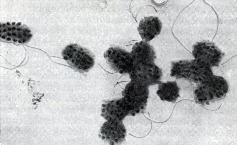 Рис. 28. Почвенная бактерия со сферическими выступами на поверхности клетки (Agrobacterium polyspheroidum). Увел. X 15000