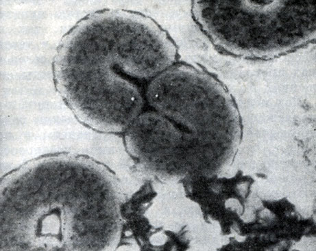 Рис. 32. Тороидальные клетки Microcyclus flavus. Электронная микрофотография. Увел. X 25000