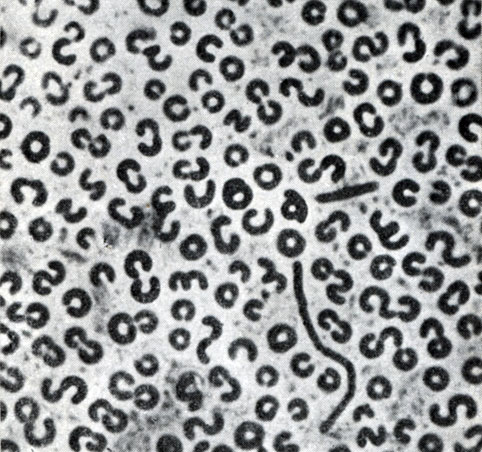 Рис. 33. Тороидальные клетки Spirosoma sp. Фазовоконтрастный микроскоп. Увел. X 1600