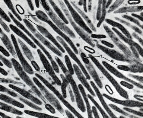 Рис. 39. Живые клетки CI. sporopenitum. Видно образование хроматпновых тяжей и проспор. XT - хроматиновые тяжи, П - проспоры. Увел. X 2000