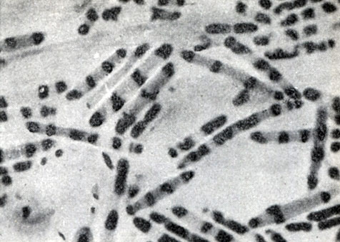Рис. 46. Молодые, интенсивно делящиеся клетки Clostridium sporopenitum. Видны делящиеся нуклеоиды. Окраска ядерного вещества по методу Романовского - Гимза. Увел. X 3500