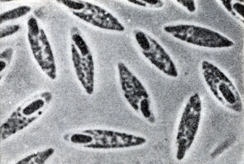 Рис. 47. Клострпдиальная форма клеток Clostridium butyricum. Увел. X 3500