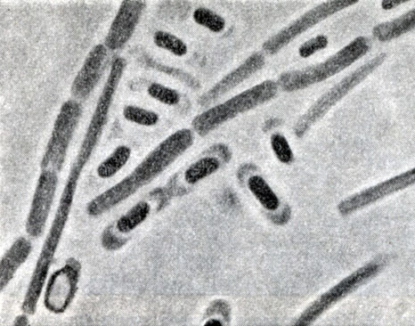 Рис. 52. Бациллярный тип спорообразования у Clostridium sporopenatum. Увел. X 3500
