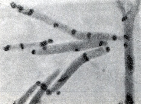 Рис. 53. Слияние нуклеоидов на полюсах клеток (перед спорообразованием). Clostridium sporopenitum Увел. X 3500