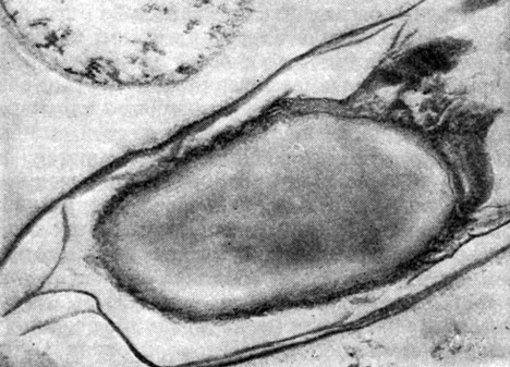 Рис. 57. Зрелая спора Clostridium penicillum. Сердцевина выглядит бесструктурной. Видны многослойный экзоспориум и выросты на оболочке споры. Увел. X 45 000.	