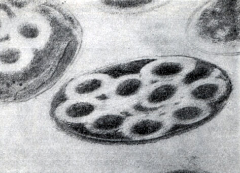 Рис. 61. Поперечный ультратонкпй срез клеток С1. penicillum. Хорошо заметен лизис цитоплазмы вокруг трубчатых выростов (светлые зоны). Увел. X 96 000