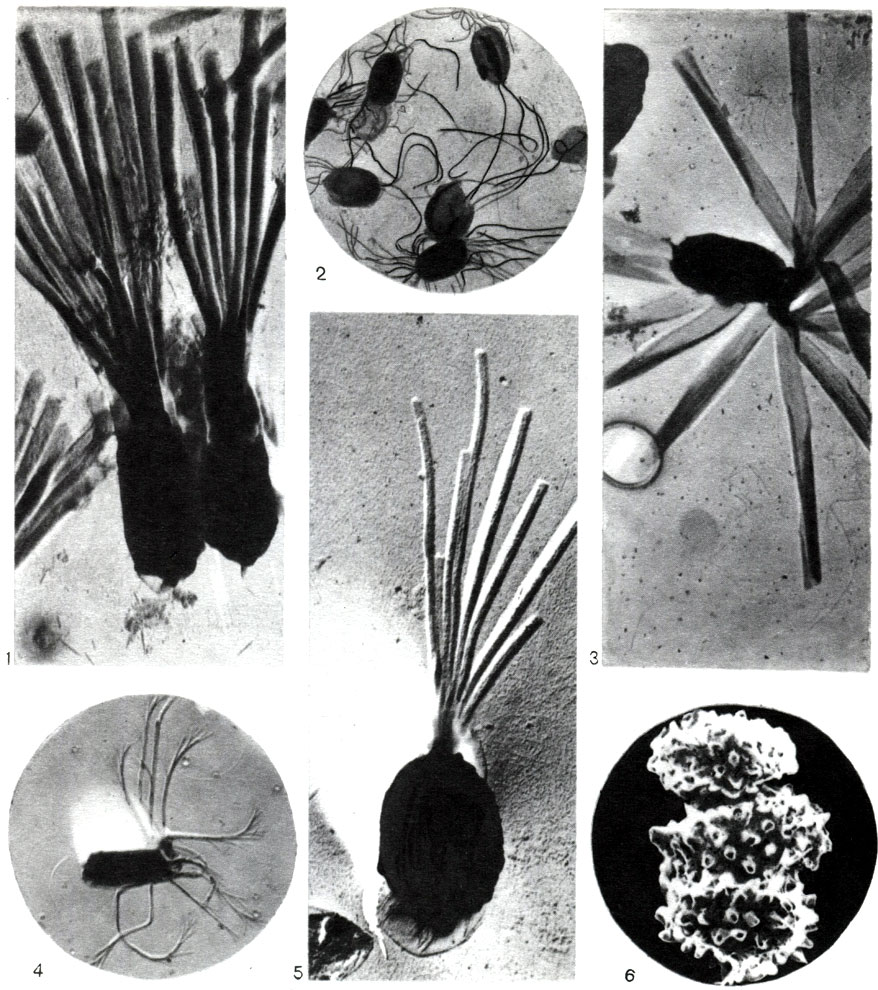 Таблица 34. Спорообразующие анаэробные бактерии: 1 - Clostridium penicillum, трубчатые выросты на спорах; 2 - CI. sporotrichum, жгутиковидные отростки на спорах; 3 - CI. taeniosporum, лентовидные выросты на спорах; 4 - CI. sporopenatum, перистые выросты на спорах; 5 - CI. sartagoformum, трубчатые выросты на спорах; 6 - Clostridium sp., споры с шипами на поверхности оболочки