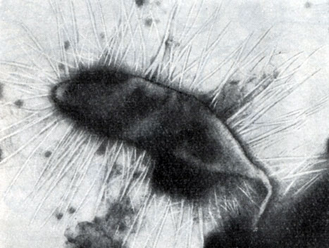 Рис. 72. Стебельковая бактерия с нетипичным тонким стебельком. Увел. X 25 000