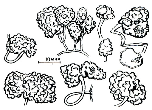 Рис. 93. Разнообразные формы спорангиев у Amorphosporangium