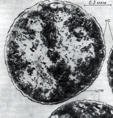 Рис. 112. Тонкое строение Neisseria catarrlialis. КС - клеточная стенка, ЦПМ - цитоплазматическая мембрана, Н - нуклеоид