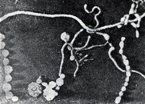 Рис. 117. Электронная микрофотография Mycoplasma mycoides (по Броку, 1970). Увел. X 20 000