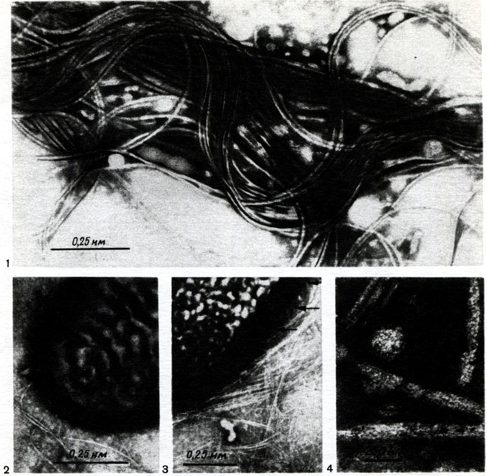 Таблица 43. Жгутики (1) и нитевидные выросты - фимбрии (2 - 4) у клеток клубеньковых бактерий люпина. Стрелками показаны места выхода фимбрий из клетки (по Майеру).