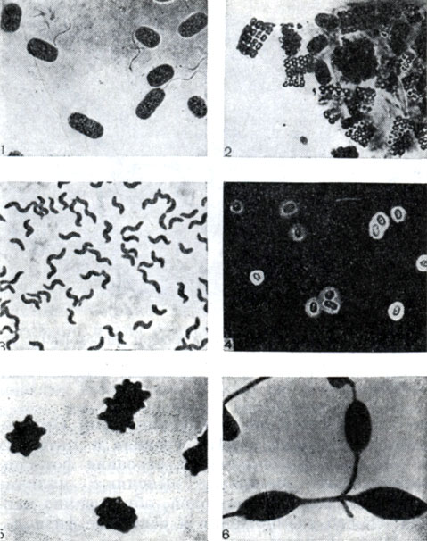 Рис. 124. Микрофотографии разных видов фототрофных бактерий. Снимки 1 - 4 сделаны в световом микроскопе, а снимки 5 - 6 - в электронном микроскопе