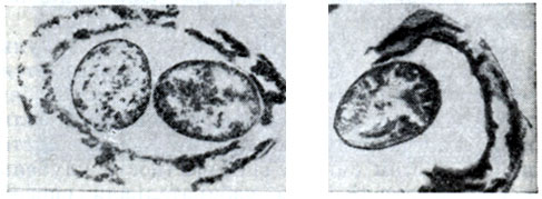 Рис. 145. Образование (слева) и выход (справа) артроспор из клеток клубеньковых бактерий клевера. Ультратонкие срезы. Увел. X 30 000